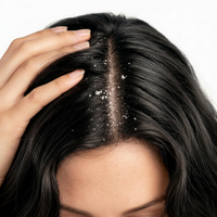Dandruff & Problem Scalp
