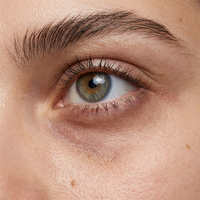 Dark Circles